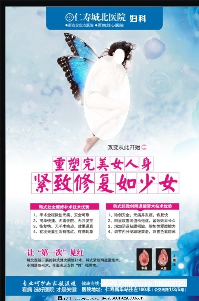 妇科健康之美 私密整形与正确医疗观念